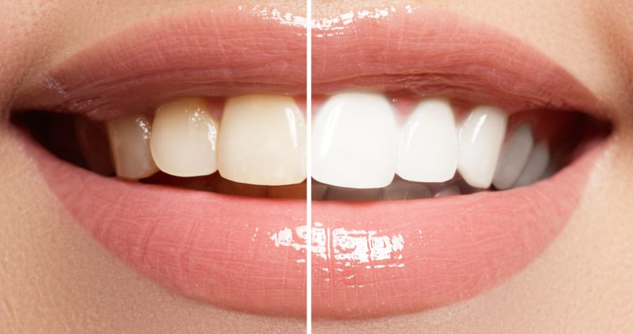 cosmetic dentistry melbourne